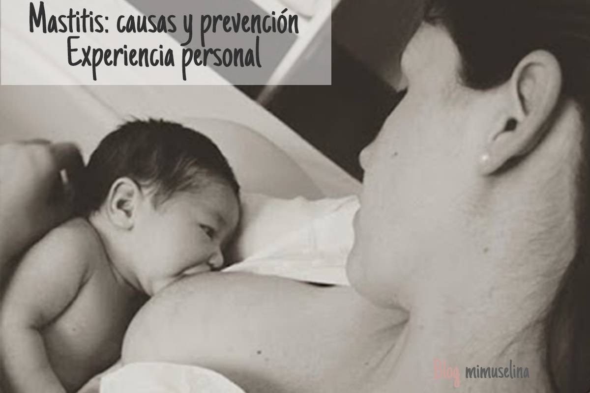 Mastitis causas y prevención lactancia materna experiencia personal de Mimuselina operación