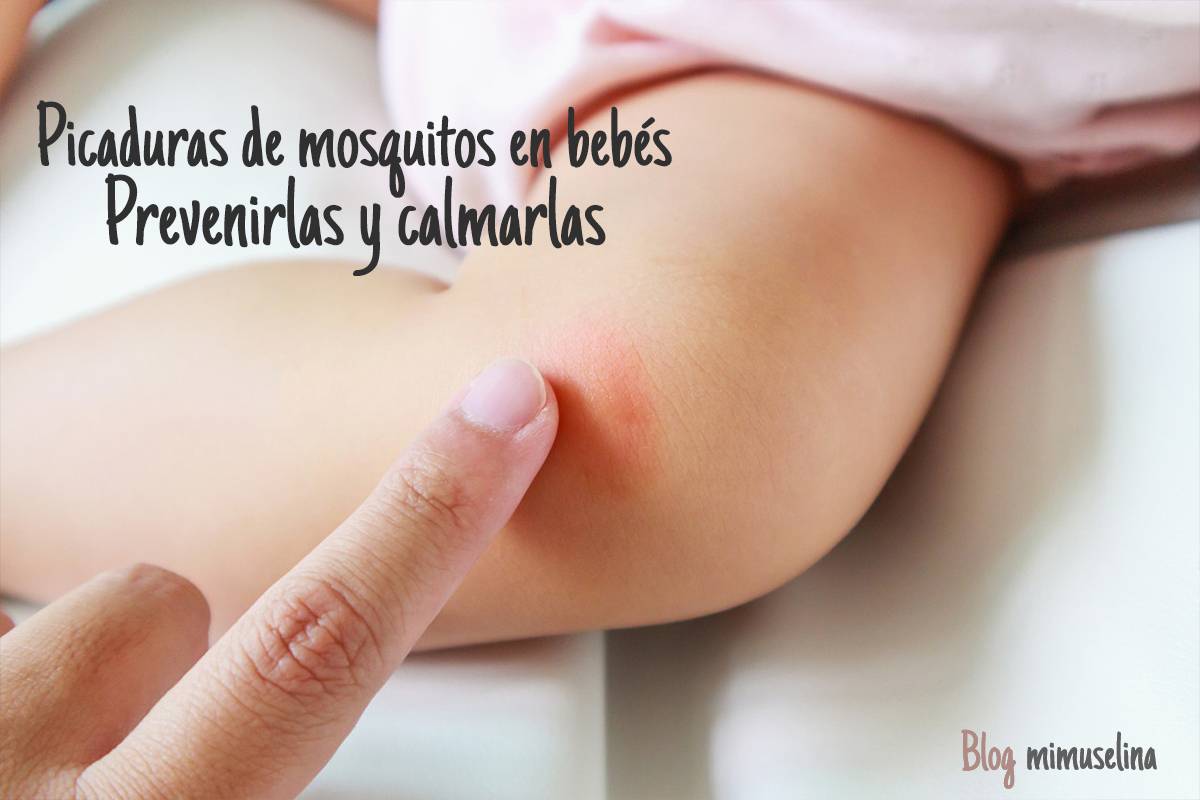 Picaduras de mosquitos en bebés y niños como prevenirlas y calmar el picor mimuselina