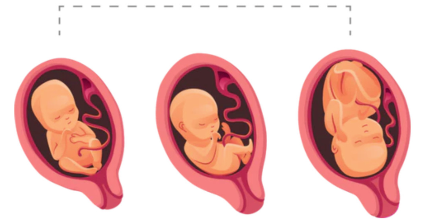 Ilustración del desarrollo del feto durante el tercer trimestre de embarazo en tres etapas distintas.
